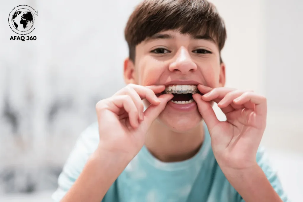 التقويم الشفاف المتحرك للاسنان