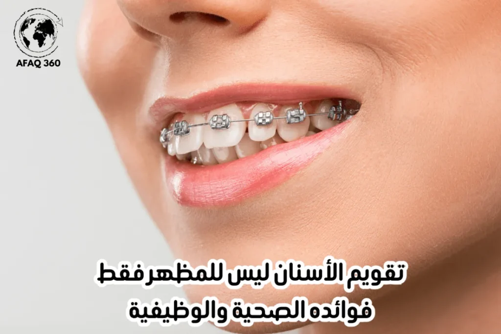 فوائد صحية لتقويم الأسنان تتجاوز المظهر! تحسين المضغ، النطق، التنفس، وعلاج آلام الفك والصداع المزمن. دليلك الشامل. اقرأ المزيد