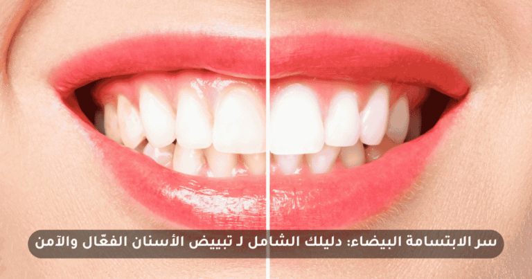 سر الابتسامة البيضاء: دليلك الشامل لـ تبييض الأسنان الفعّال والآمن