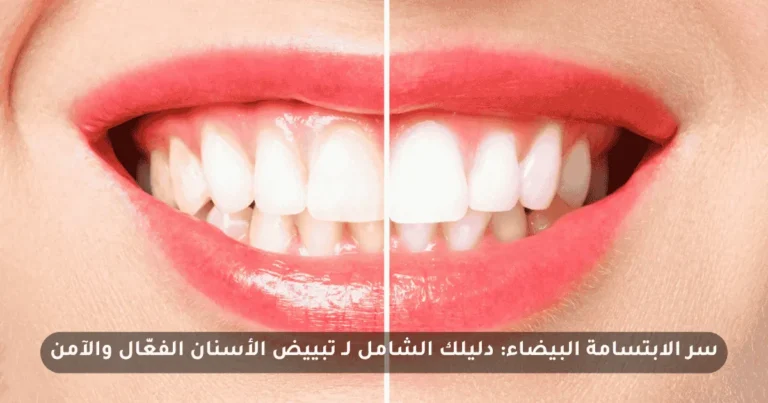 سر الابتسامة البيضاء: دليلك الشامل لـ تبييض الأسنان الفعّال والآمن
