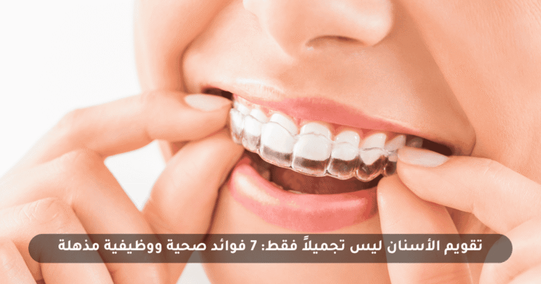 تقويم الأسنان ليس تجميلاً فقط: 7 فوائد صحية ووظيفية مذهلة