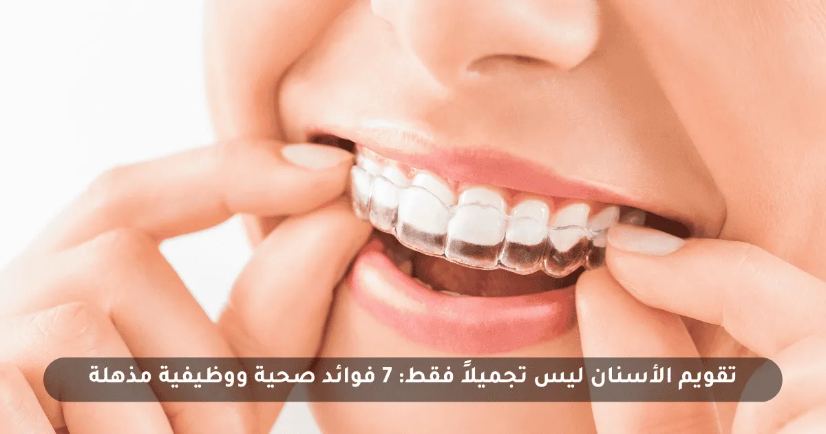 تقويم الأسنان ليس تجميلاً فقط: 7 فوائد صحية ووظيفية مذهلة