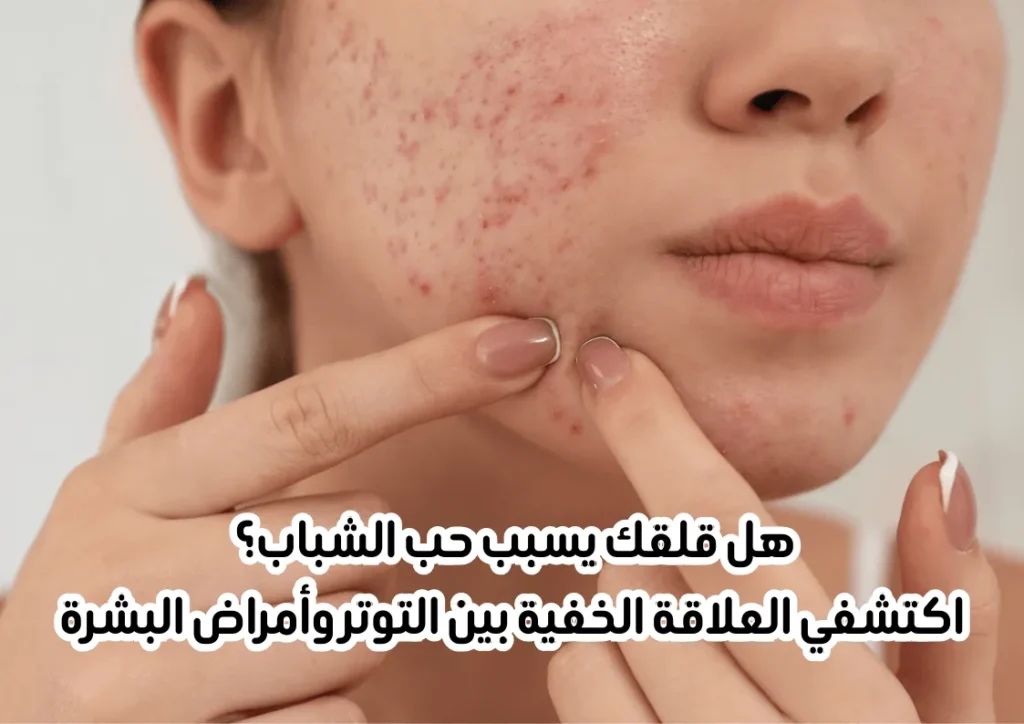 مشاكل البشرة:  التجاعيد واثار التوتر  وحب الشباب