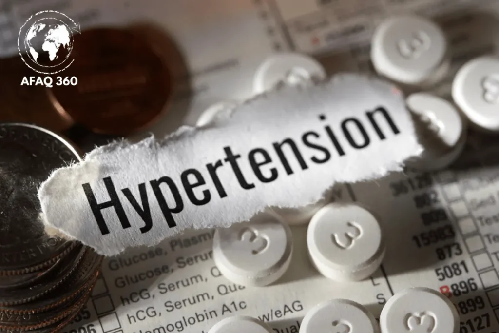 دليل شامل لإدارة وعلاج ارتفاع ضغط الدم و