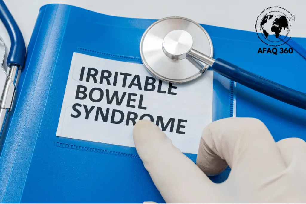 القولون العصبي: الدليل الشامل 