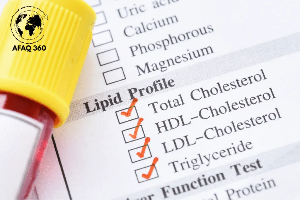 الكوليسترول والدهون المشبعة الكوليسترول والدهون المشبعة