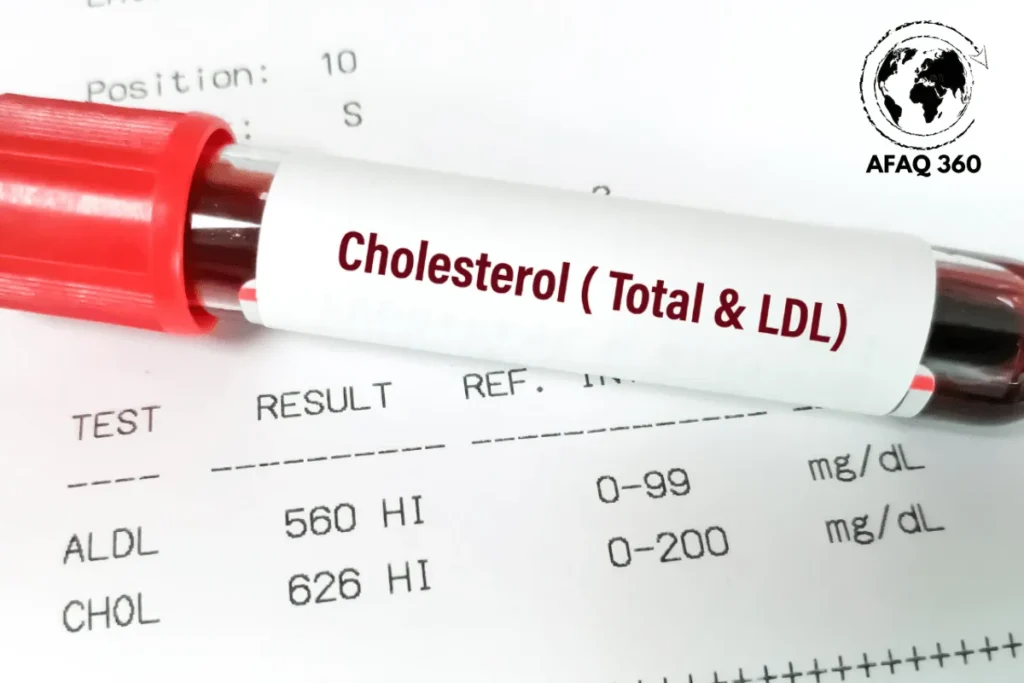 الكوليسترول والدهون المشبعة الكوليسترول والدهون المشبعة