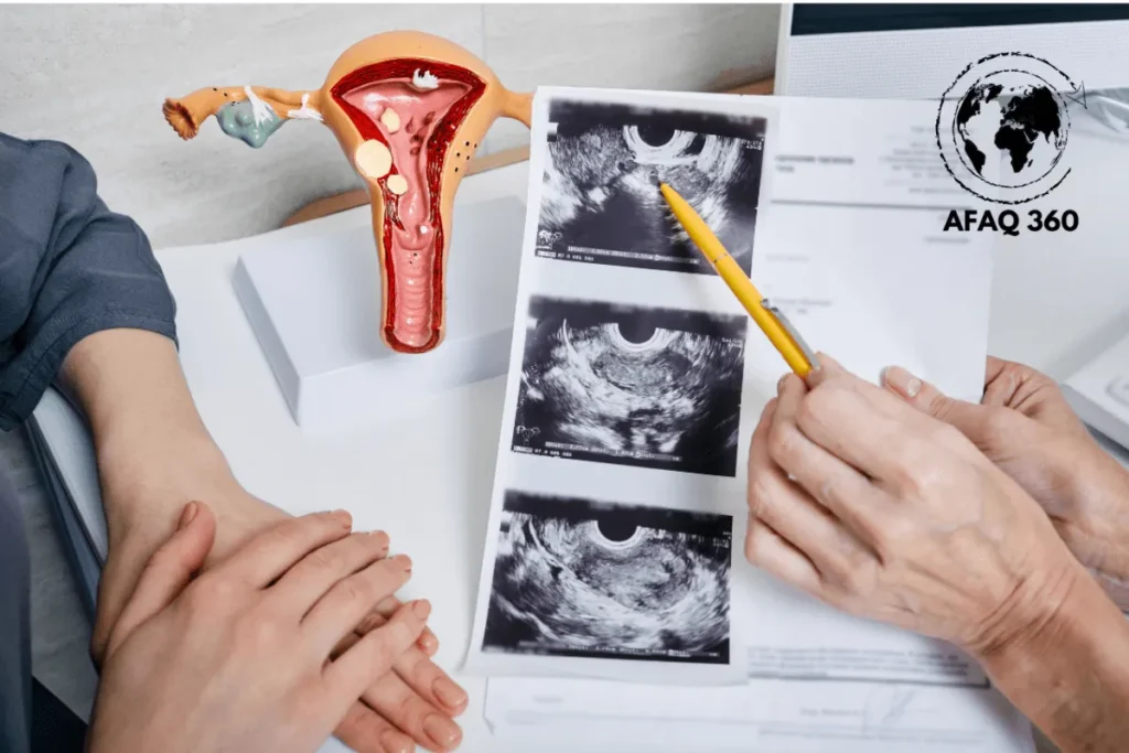 هرمونات المرأة